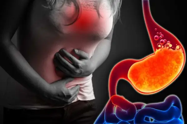 GERD Treatment in Coimbatore | Acid Reflux Specialist - Dr. K. Balu