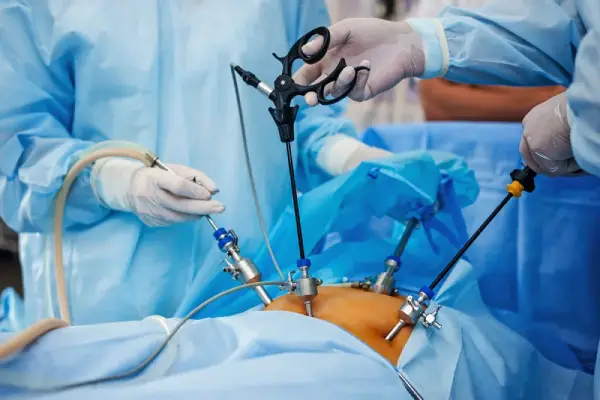 Best Laparoscopic Surgeon in Coimbatore - Dr. K. Balu