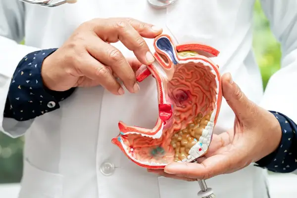 Stomach Cancer Treatment in Coimbatore - Dr. K. Balu