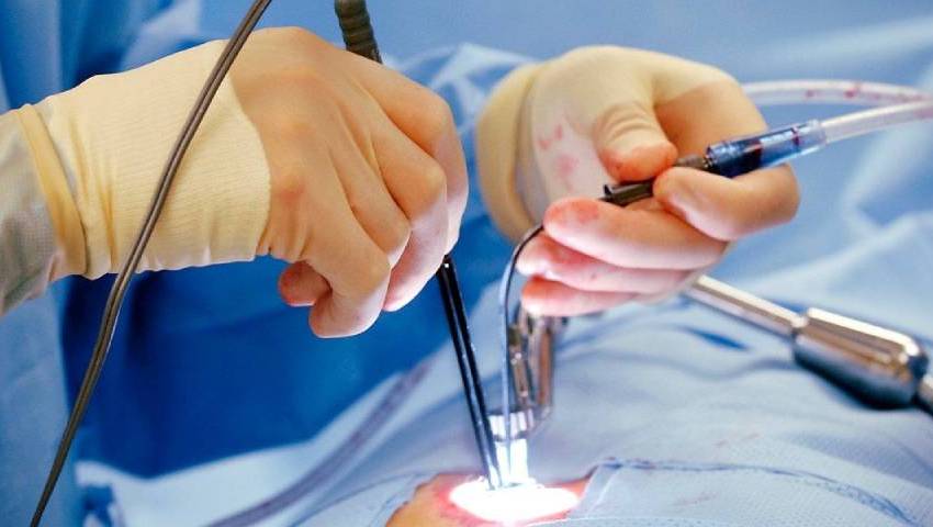 Laser treatment in proctology being performed using minimally invasive instruments during a surgical procedure