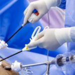 Top 10 Advantages of Laparoscopic Surgery You Should Know