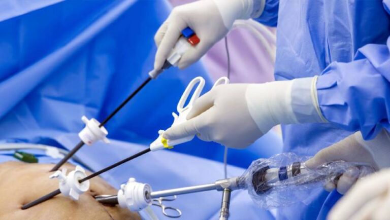 Top 10 Advantages of Laparoscopic Surgery You Should Know