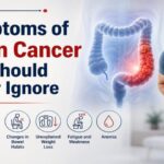 Symptoms of Colon Cancer You Should Never Ignore