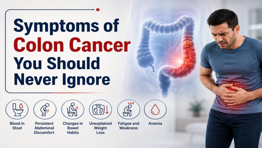 Symptoms of Colon Cancer You Should Never Ignore Symptoms of Colon Cancer You Should Never Ignore