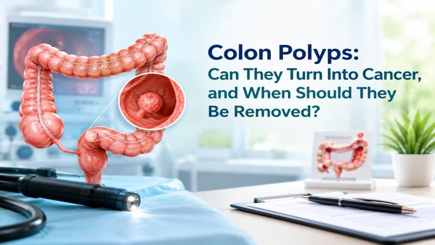 Illustration of colon polyps with a magnified polyp and a colonoscope, explaining if colon polyps can turn into cancer